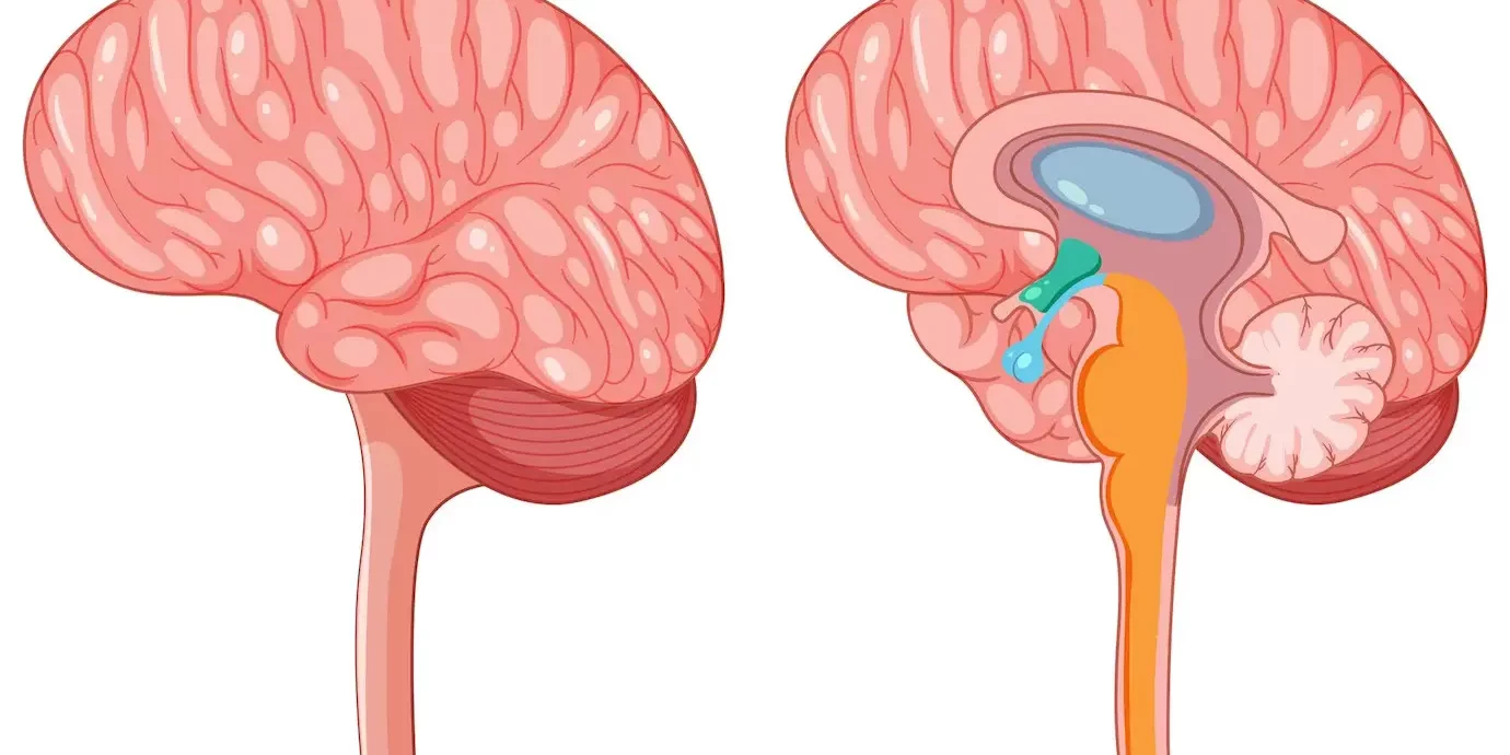 Cerebellopontine Angle Tumor Cerebellopontine Angle Tumor