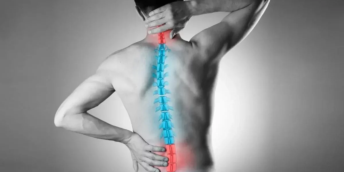 Spine fixation