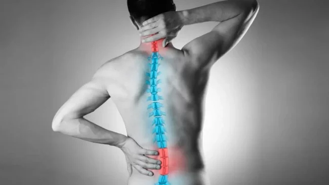 Spine fixation Spine fixation
