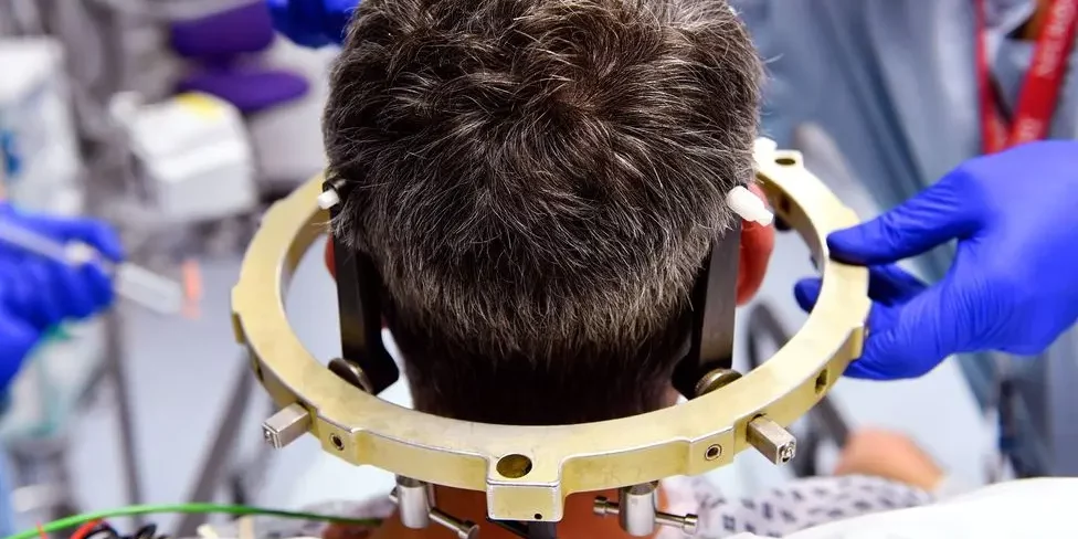 Stereotactic Brain Tumor Surgery